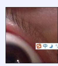 怎么按本身的小豆豆(医生指尖摩擦着小豆豆)