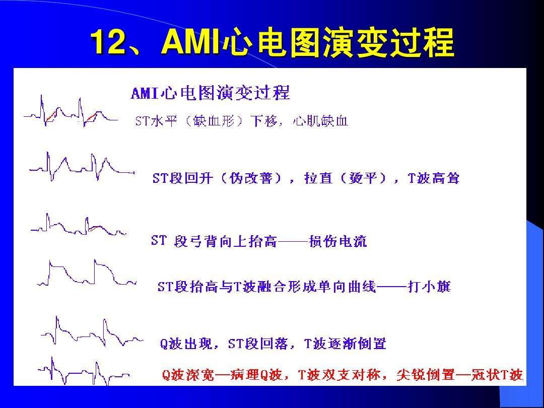 看心电图的七个步调(看懂心电图的十大口诀)